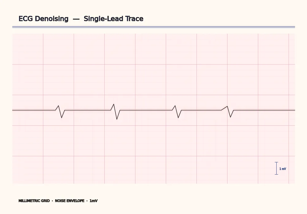 ECG filtering traces