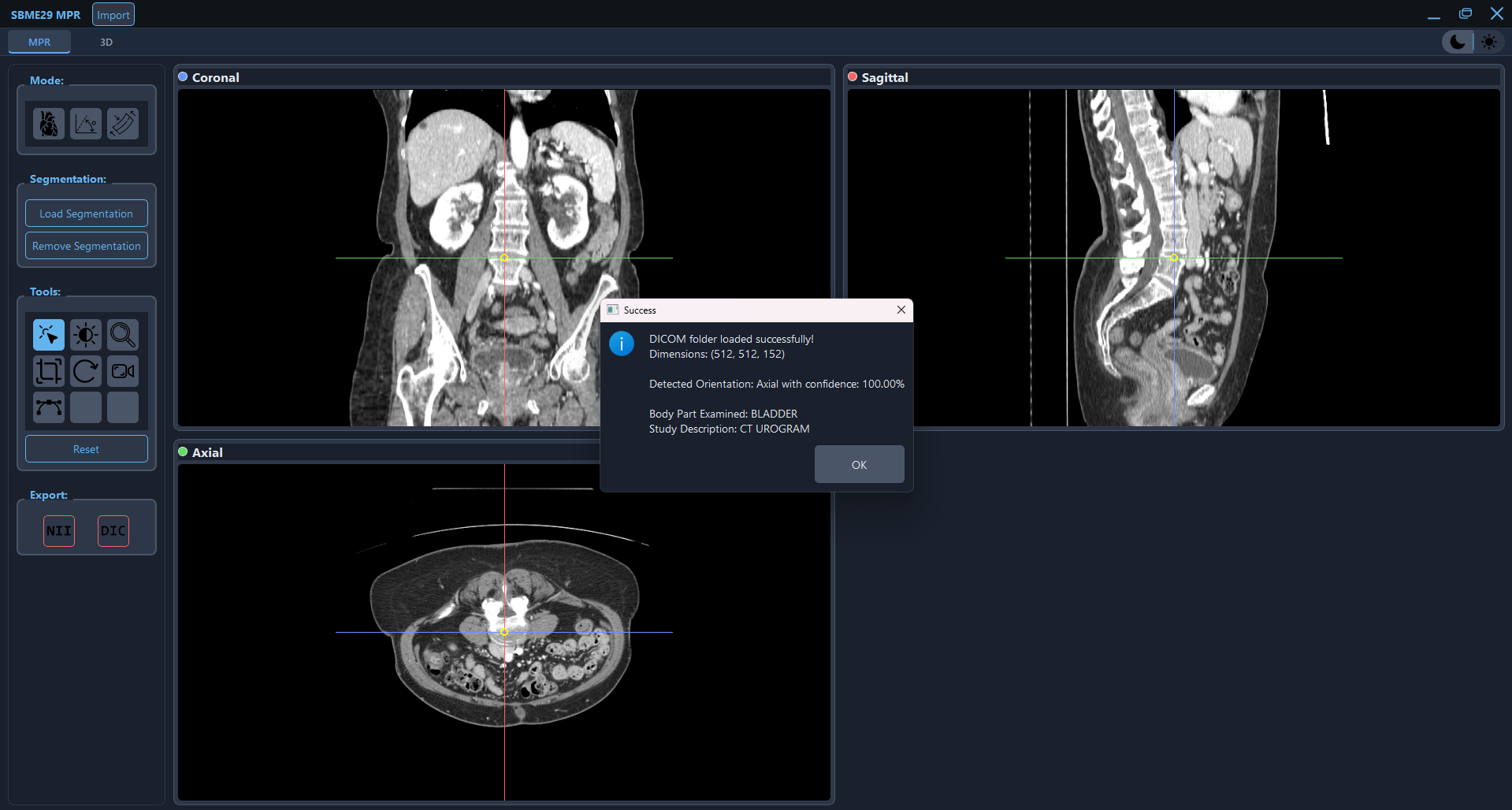 SBME-MPR Medical Viewer