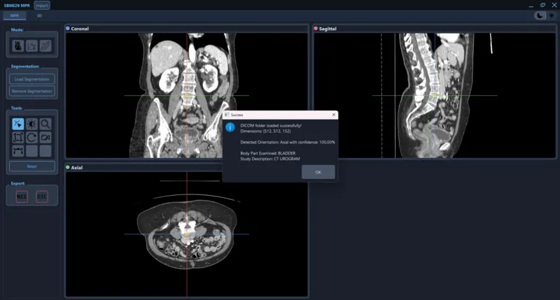 SBME-MPR multi planar views